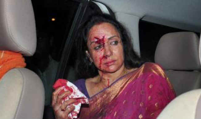 Shocking Hema Malini Injured In A Car Accident Pi