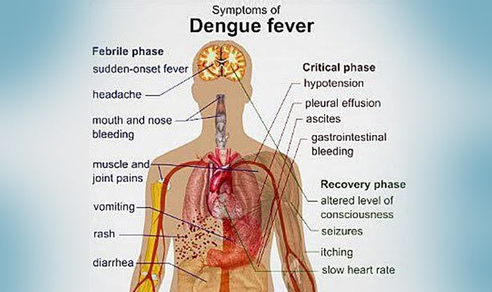 Symptoms Of Dengue Fever