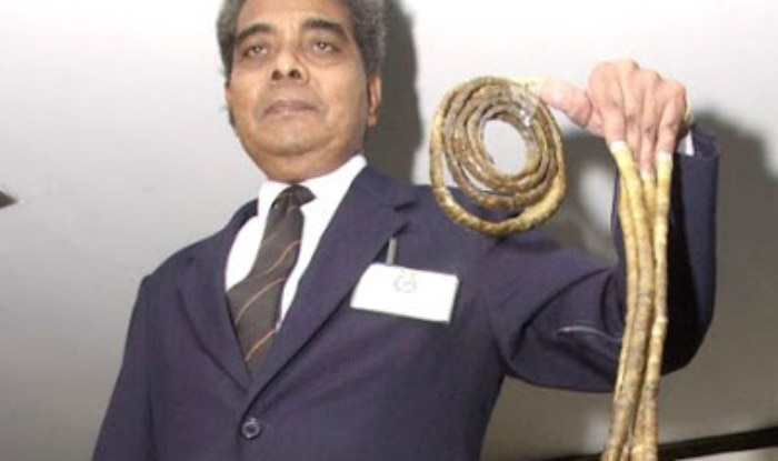 Indias Shridhar Chillal Sets Guinness World Records For Longest Fingernails On One Hand