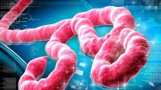 UN: 2 new Ebola cases in Guinea show virus still spreading UN: 2 new Ebola cases in Guinea show virus still spreading