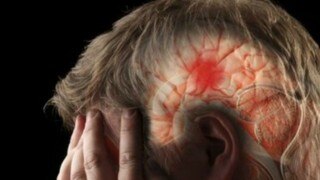 World Stroke Day: 5 Important Facts About Stroke That Everybody Should be Aware Of World Stroke Day: 5 Important Facts About Stroke That Everybody Should be Aware Of