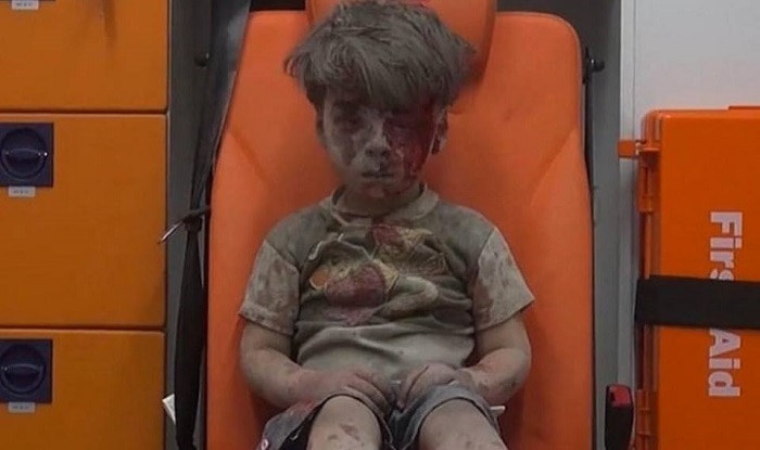 Brother of Syrian boy in iconic airstrike photos dies