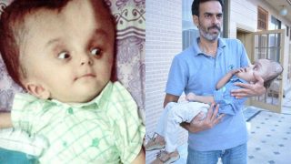 Pakistani Baby with enlarged head undergoes life-saving surgery in US, thanks to a Good Samaritan! (See Pictures) Pakistani Baby with enlarged head undergoes life-saving surgery in US, thanks to a Good Samaritan! (See Pictures)