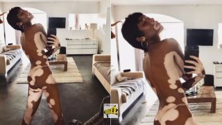 Winnie Harlow is Almost Naked in New Picture: Fashion Model with Vitiligo Proudly Poses for Bold Mirror Selfie Winnie Harlow is Almost Naked in New Picture: Fashion Model with Vitiligo Proudly Poses for Bold Mirror Selfie