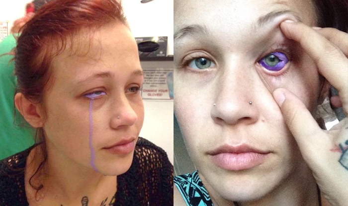 canadian model catt gallinger is recovering after eye canadian model catt gallinger is recovering after eye