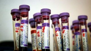 Turns Out That A Battalion Of ‘Harmful’ Antibodies In Your Immune System, That Are Muted By The Body, Can Actually Protect You Against Tough Conditions Like HIV Turns Out That A Battalion Of ‘Harmful’ Antibodies In Your Immune System, That Are Muted By The Body, Can Actually Protect You Against Tough Conditions Like HIV