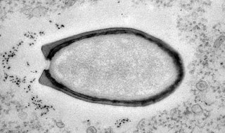 Giant Virus in Siberia discovered by scientists