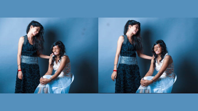 Rahul Saharan’s Inspiring Photo Shoot of Acid Attack Victims that went Viral