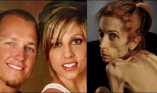 Anorexic California woman Rachael Farrokh pleads for HELP! (Watch video)
