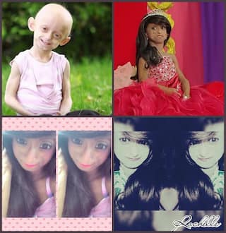 This 18-year-old Progeria patient is living the life of Amitabh Bachchan in Paa, but in style!