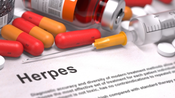 herpes-medicine