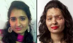 Acid attack survivor Reshma Quereshi's beauty tips on red lips make a point against acid sale!