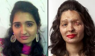 Acid attack survivor Reshma Quereshi's beauty tips on red lips make a point against acid sale!