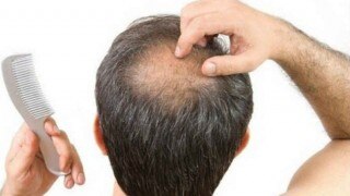 Grow Hair on Bald Head With This New Wearable Device, Read on