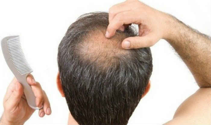 Grow Hair On Bald Head With This New Wearable Device Read On