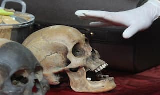 11 Skulls, 54 Bones Of Foetuses Found At Hospital In Maharashtra's Wardha, Probe Underway