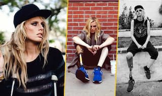 This 24-year-old model had to amputate her leg after using tampons!