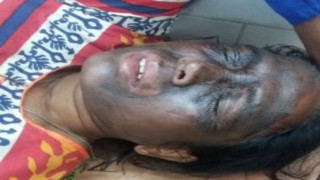 'Acid attack' victim Soni Sori's condition stable; Chhattisgarh police deny role in attack