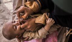 Polio virus likely to strike India again after 5 years; Telangana sounds 'global emergency'