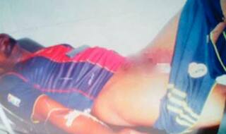 युवक ने की रेप की कोशिश तो लड़की के काटा उसका प्राइवेट पार्ट