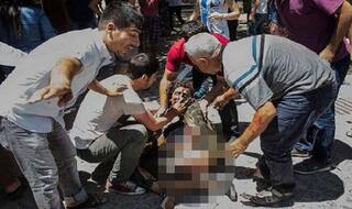 Kabul blast: 55 dead in explosion, dozens injured; Taliban hand suspected
