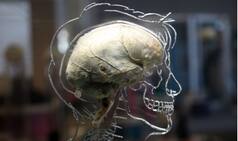 Special drug rushed to help brain-eating amoeba patient in Carolina