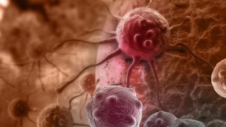 कैंसर से लड़ने में कारगर साबित हो सकती है नई स्टेम सेल तकनीक, रिसर्च का दावा