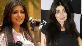 Ayesha Takia, latest victim of plastic surgery gone wrong in Bollywood? Actress' pictures post lip job keep Twitterati abuzz!