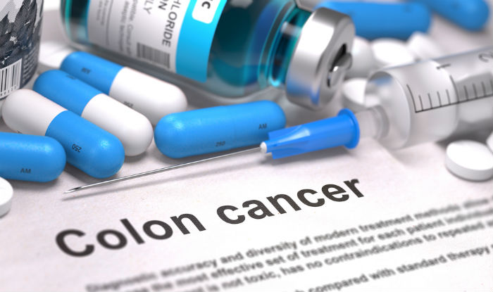 Colorectal Cancer Symptoms Prevention And Treatment For Colon