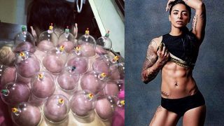 Bani J goes through Chinese cupping therapy, shares picture on Instagram with a strong message
