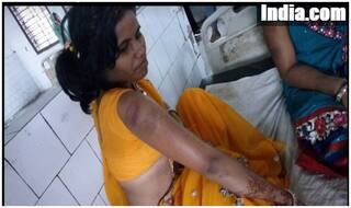 दुल्हन के निजी अंगों को जख्मी करने वाले आरोपी पुलिसवाले लाइन हाजिर