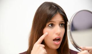 These are the 5 most effective home remedies to get rid of dark circles!