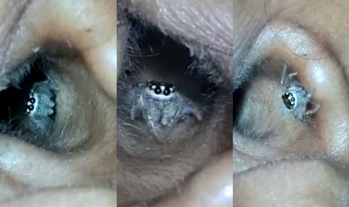 Spider crawls out of Indian woman’s ear! Watch terrifying video of ...