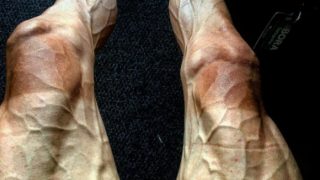 Tour de France Cyclist Pawel Poljanski Shares Gruesome Picture of His Legs