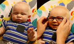 Priceless Reaction of Baby With Albinism Seeing Mother For First Time With Glasses is Going Viral (Watch Video)