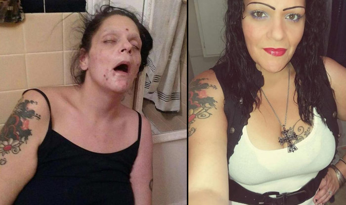 Woman Shares Before And After Photos Of The Ill Effects Of Drug Addiction In A Viral Facebook Post See Pictures India Com