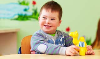 European Women Choose Abortion When Tested Positive for Down Syndrome: What is Down Syndrome? What are its causes and symptoms?