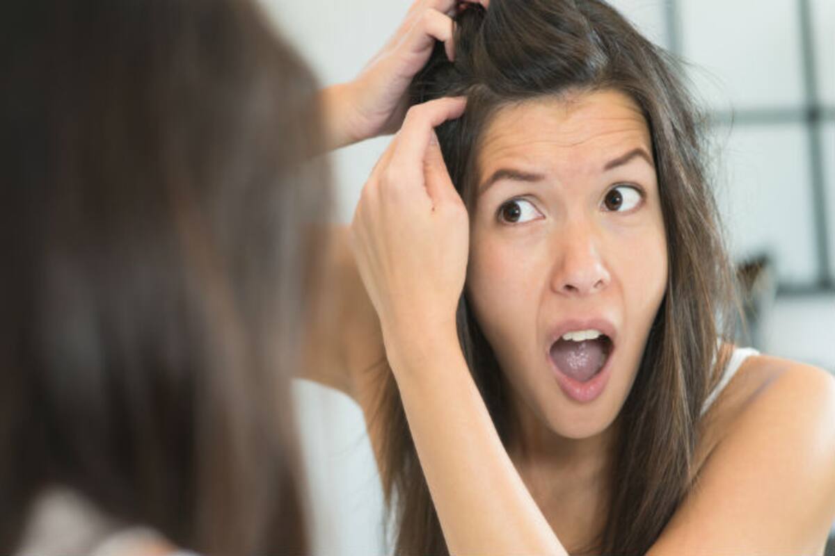 Home Remedies For Grey Hair 5 Effective Home Remedies To Get Rid