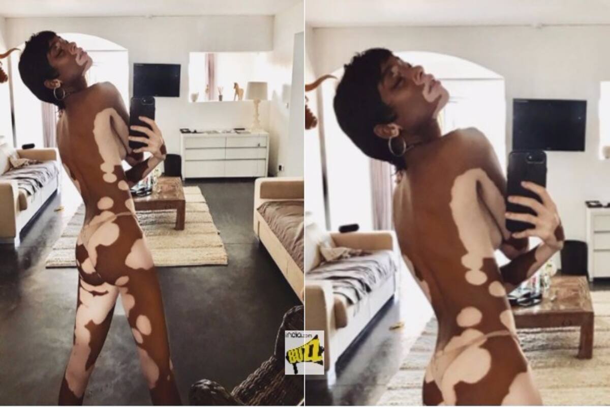 Winnie Harlow is Almost Naked in New Picture: Fashion Model with ...
