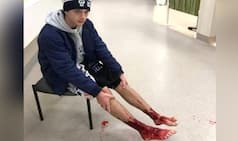 Australian Teenager's Feet Bleeds Profusely After Being Bit by 'Tiny Sea Creatures'