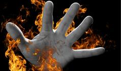 Uttarakhand Woman Set Ablaze by Stalker, Shifted to Delhi in Critical Condition