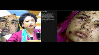Pakistan's UN Ambassador Maleeha Lodhi Shows Palestinian Victim as Kashmiri With Pellet Gun Injuries