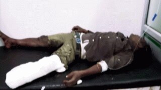 डॉक्टरों ने दोनों पैरों के बीच रख दिया मरीज का कटा पैर, दर्द से चिल्लाता रहा घायल