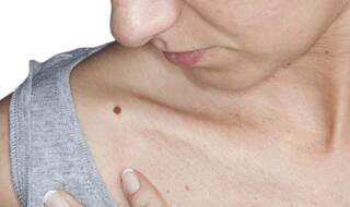 Skin Cancer के खतरे को 40% तक कम करते हैं इस तरह के Body Lotion