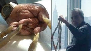 Shridhar Chillal Finally Cuts His Fingernails After 66-Years in Nail Clipping Ceremony in New York; Video Goes Viral
