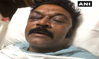 कर्नाटक में कांग्रेस विधायकों के बीच हुई थी मारपीट, घायल MLA आनंद सिंह की है ये फोटो