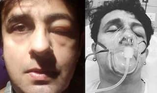 खाना खाने के बाद कुछ ऐसा हो गया था सोनू निगम का हाल, फिलहाल हालत में सुधार