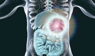 Eating Low Calorie Diet That Mimics Fasting Can Help Treat Inflammatory Bowel Disease