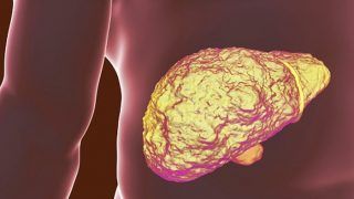 5 Life-Saving Tips For a Healthy Liver 5 Life-Saving Tips For a Healthy Liver
