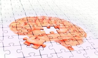 Alzheimer's Disease: 5 Natural Ways to Improve Your Brain Health And Fight Dementia